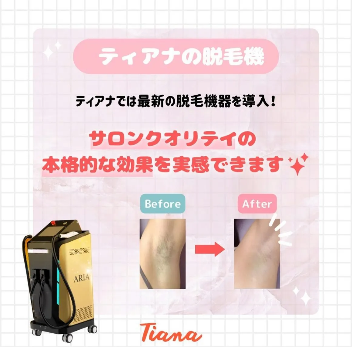 ✨️Tianaセルフ脱毛サロン✨️通い放題・脱毛し放題プラン...