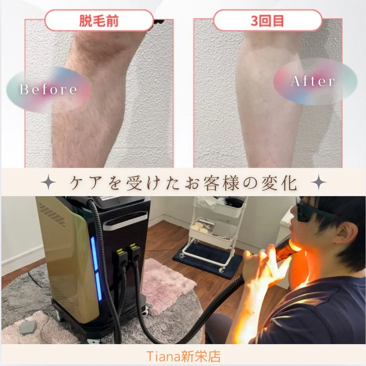 💡Tianaで施術を受けてくださった方の効果💡