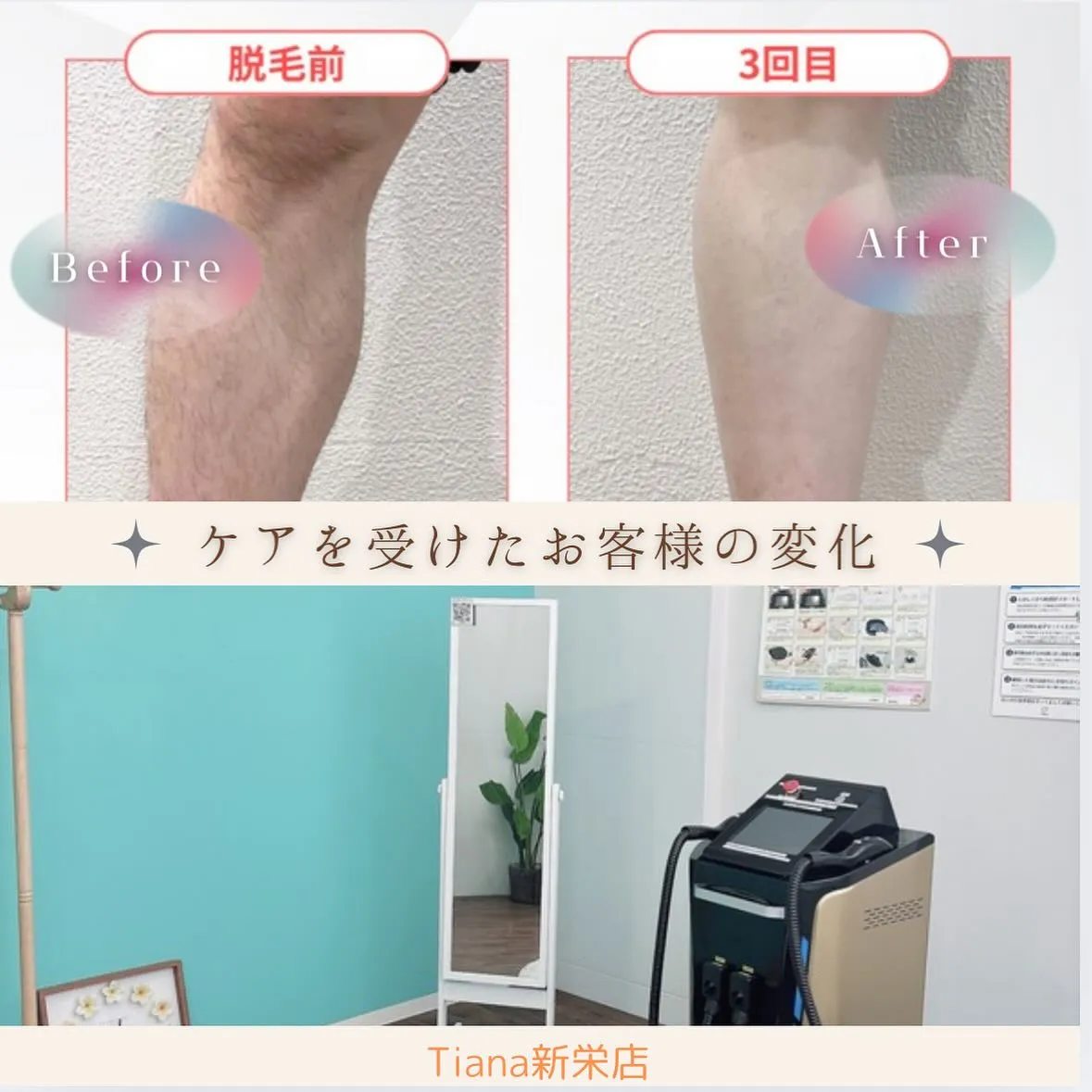 💡Tianaで施術を受けてくださった方の効果💡